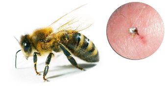 Dans la composition de Hondrostrong comprend le venin d'abeille, qui améliore le métabolisme des tissus